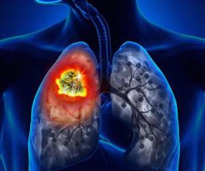 Portland, Oregon: a TOXIC AIR MESS